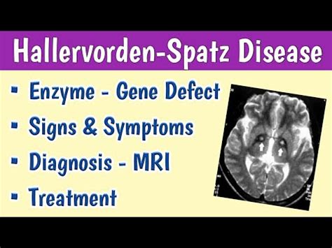 hallervorden spatz disease